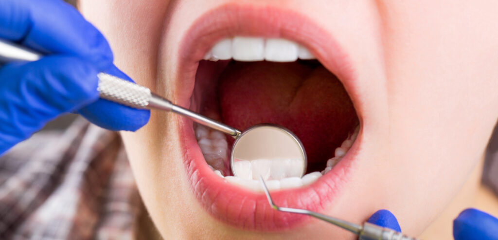 Oral Exams - PHC Dental Care of Miami Florida