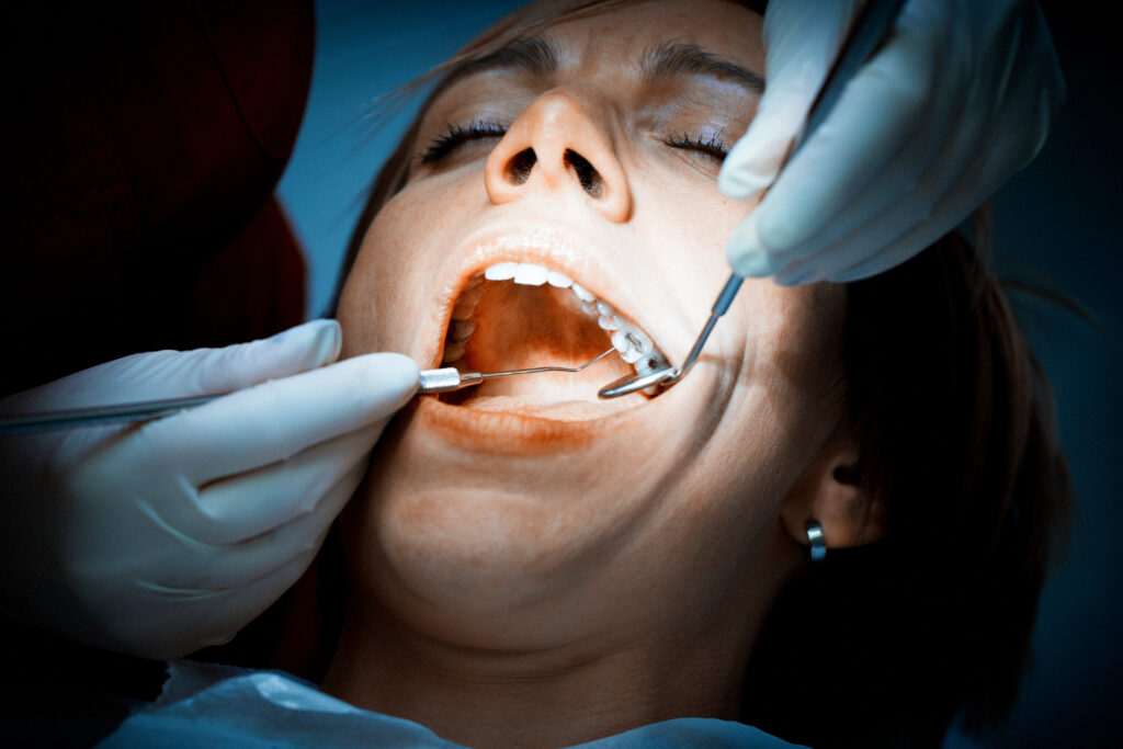 Periodontal Treatment - PHC Dental Care of Miami Florida